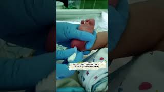 Pengambilan sampel SKRINING HIPOTIROID KONGENITAL (SHK) pada bayi screenshot 4