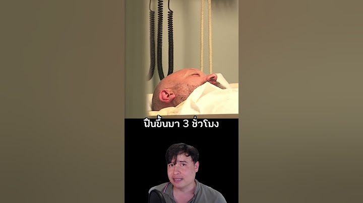 แกล้งเพื่อนว่าอยู่ในอาการโคม่า 10 ปี แต่ทั้งหมดเพื่อหวังดี #ไวรัล #เรื่องเล่า #เพื่อนแท้ #shorts