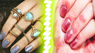 What to do if Allergic to artificial jewellery ? | Admire Beauty