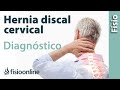 Cómo saber si tienes una hernia discal cervical.