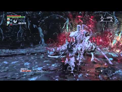 ブラッドボーン 劇毒雷光の慈悲刃 Vs 死体の巨人 Bloodborn Blade Of Mercy Vs Undead Giant Youtube ブラッドボーン 劇毒雷光の慈悲刃 Vs 死体の巨人 Bloodborn Blade Of Mercy Vs Undead Giant Youtube