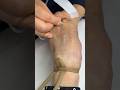 Intramuscular Injection Technique Explained | Safe IM Injection Step-by-Step | Nurse Guide Class 14