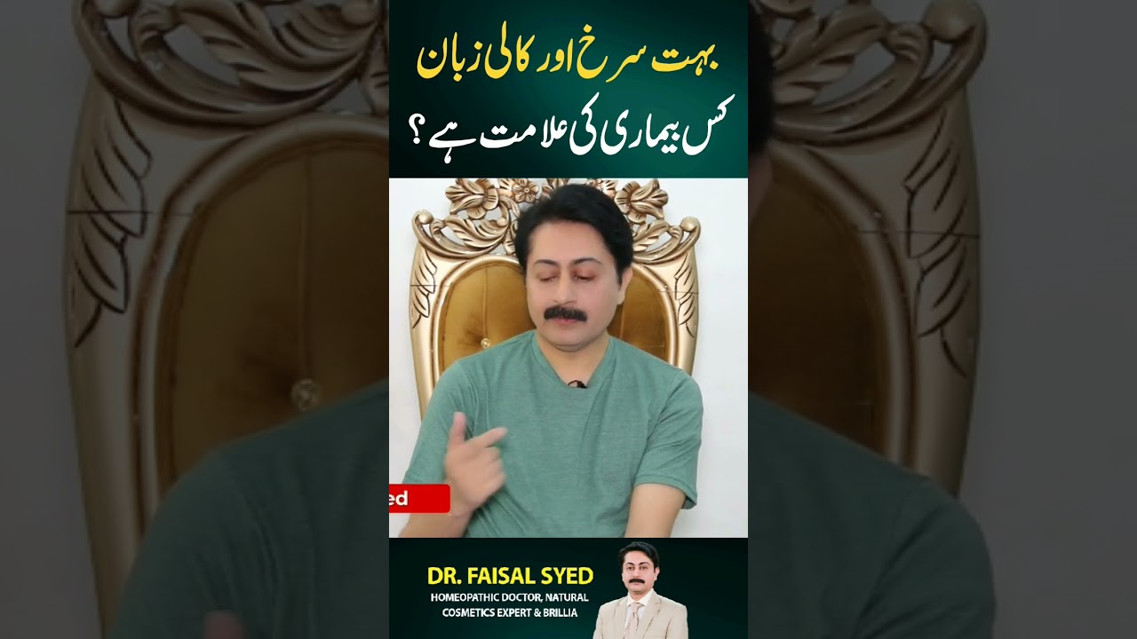 Kali zuban kis bemari ki Alamat h? #drfaisalsyed