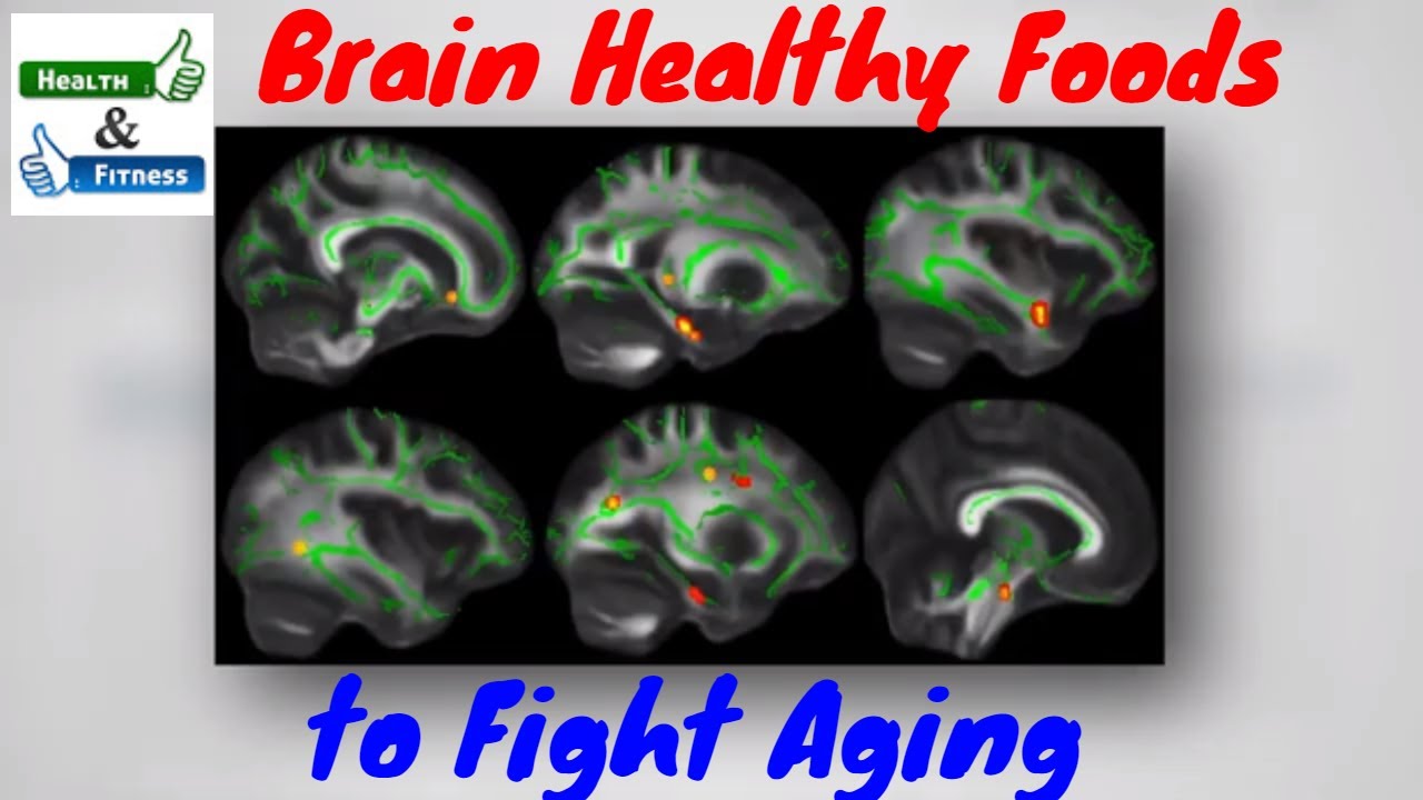 Brain Healthy Foods to Fight Aging