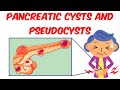 Pacreatic Cysts And Pancreatic Pseudocysts!