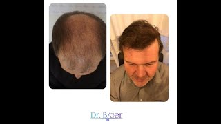 Patient Result - 11 - Dr. Özlem Biçer