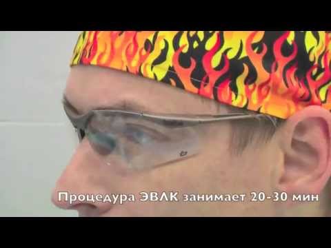 Вены нижних конечностей схема