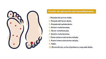 ¿Qué le ocurre a los dedos de los pies de un diabético?