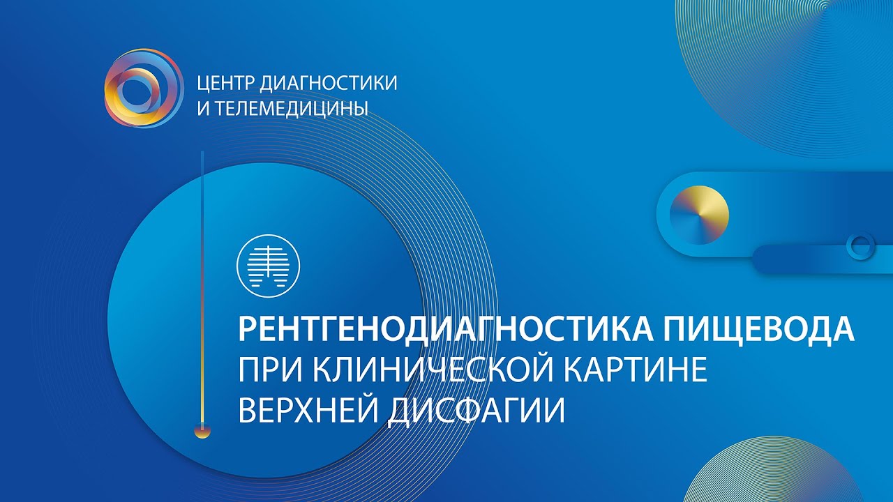 Рентгенодиагностика пищевода при клинической картине верхней дисфагии ...