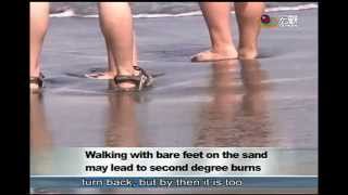 到海邊被沙灘嚴重燙傷的案例今年已經20幾件 Beach goers were seriously burned on the beach —宏觀英語新聞