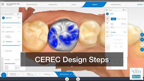 CEREC Software 5 Step Design Workflow