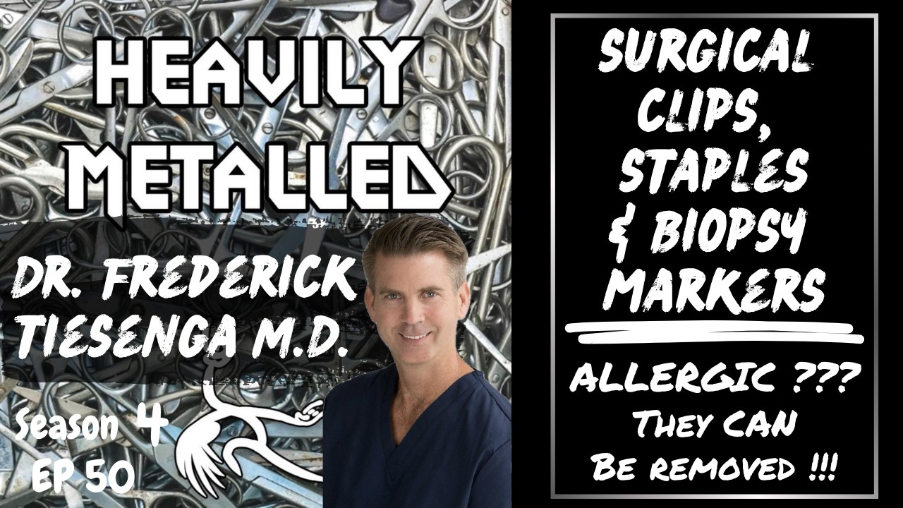 EP50 - Surgical Clips, Staples/Biopsy Markers-Allergic? They CAN Be Removed-Dr. Fred Tiesenga, M.D.