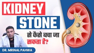 Kidney Stone से कैसे बचा जा सकता है | Kidney Stone Treatment and Prevention | Dr Mrinal Pahwa