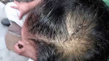 Taking staples out of Larry