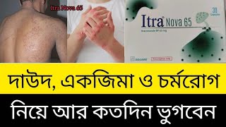 Itra Nova 65 Mg Capsule কজ ক, দউদ, একজম ও চরমরগ নয আর কতদন ভগবন