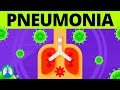 Pneumonia Overview | Causes, Symptoms, Diagnosis, and Treatment