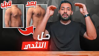 أسباب وعلاج التثدي عن الرجال !!