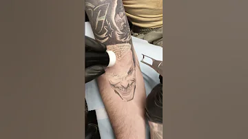 Laser Tattoo Removal Before And After Progress Shorts Beforeandafter Lasertattooremoval 