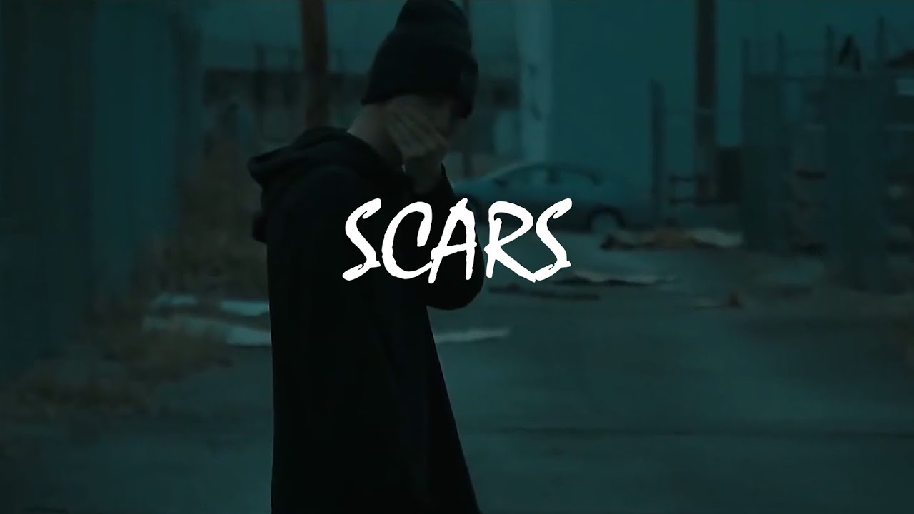 Watch (Free) NF Type Beat - Scars on YouTube Watch (Free) NF Type Beat - Scars on YouTube