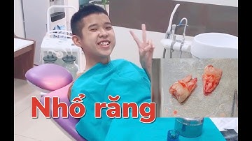 Tôm đi nhổ răng khôn mọc ngu | Nhổ răng có thực sự đáng sợ? - Tôm tiktok vlog tập 3 #Shorts