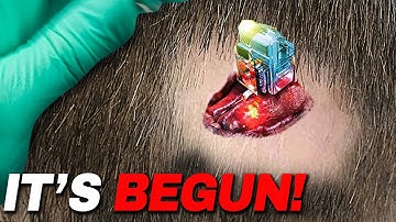 The NEURALINK Update for 2023 is HERE!