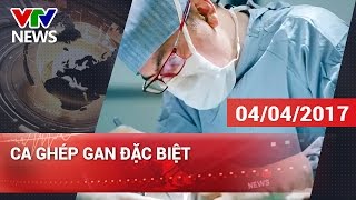 CA GHÉP GAN ĐẶC BIỆT | CHÀO BUỔI SÁNG VTV [04\/04\/2017]