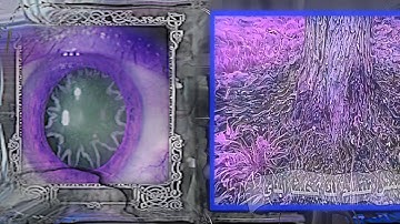 ༺ྏ༼ུ༔།༠།༷ཆ།༠ཉⵞⵞAETERNA SOMNIAⵉⴽⴽⵓ༔།༠།༷ཆ།༠ཉ༽ྎ༻ [music video]