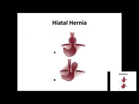 Digestion Part 2 Stomach to Anus