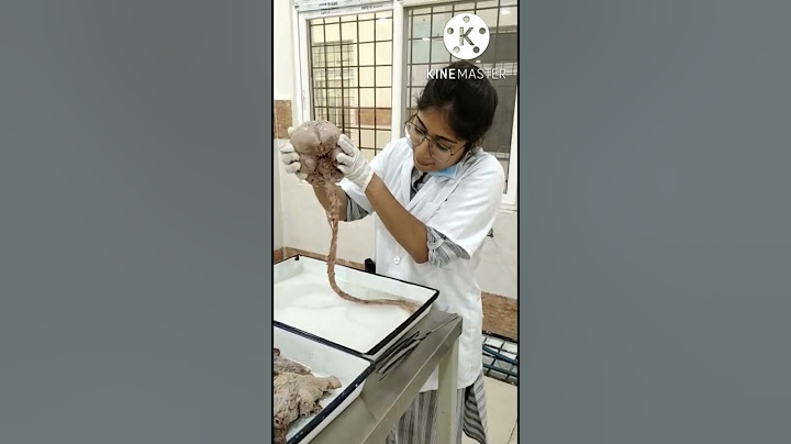 medical college dissection hall brain and spinal cord #shorts #short #ytshorts #shortsvideo #viral