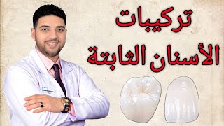 تركيبات الاسنان الثابتة | انواعها و اسعارها