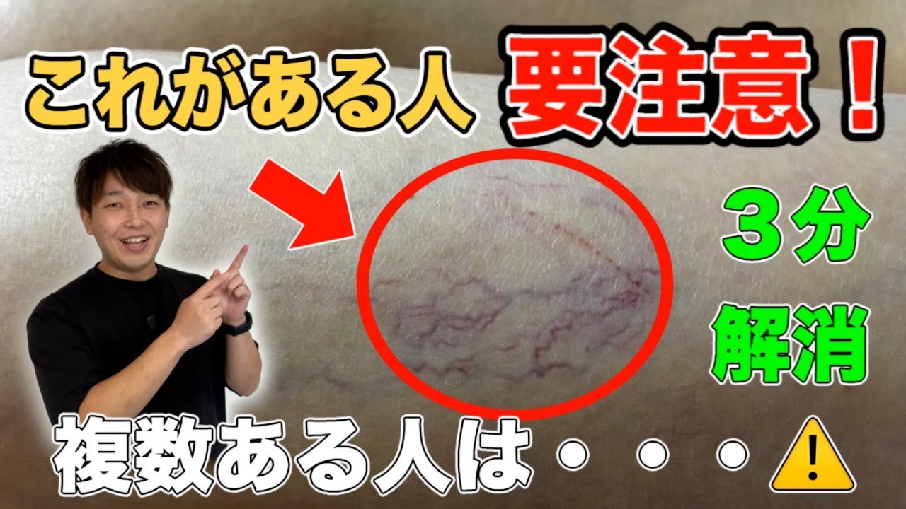 【放置厳禁！】細絡（さいらく）改善するだけで『老化防止・脂肪燃焼・代謝アップ｜内臓脂肪/中性脂肪 減少｜眼精疲労・頭痛・首/肩こり・腰痛・股関節痛・膝痛すべて解消』