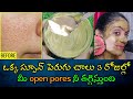 🔴How to Remove Open pores , Large pores😱 , Clogged pores😲 Naturally in Telugu | 🥰100% working Remedy