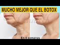 Rejuvenece 10 aos mejor que el botoxrejuvenece reafirma quita manchasflacidez en el cuello