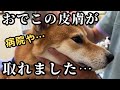 おでこの皮膚が取れたので、病院に行きました