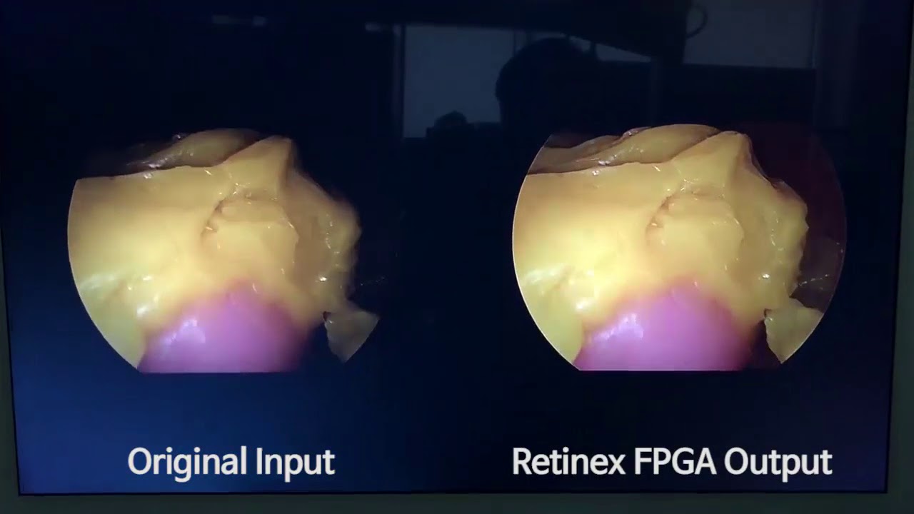 Retinx Software Real-time Retinex Hardware Demo, CAPP - YouTube