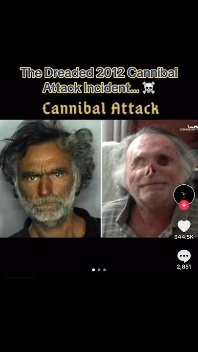 The Dreaded 2012 Cannibal Attack Incident ☠️ #disturbing