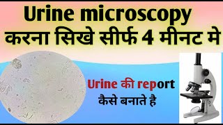 Urine Under the Microscope | Normal vs Abnormal Findings