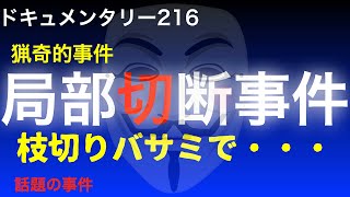 【猟奇的】局部切断事件『枝切りバサミで・・・』