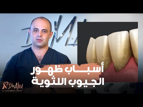 الحكيم في بيتك كبسولة الحكيم الجيوب اللثوية مع الدكتور محمد العالم