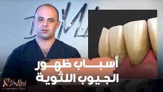 الحكيم في بيتك  كبسولة الحكيم “الجيوب اللثوية” مع الدكتور محمد العالم