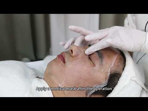 How to Perform a CO2 Laser Resurfacing Procedure: A Step-by-Step Guide