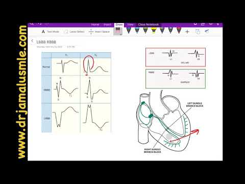 lbbb-and-rbbb-(left-vs-right-bundle-branch-block)--dr-jamal-usmle---cardiology-ecg-lecture