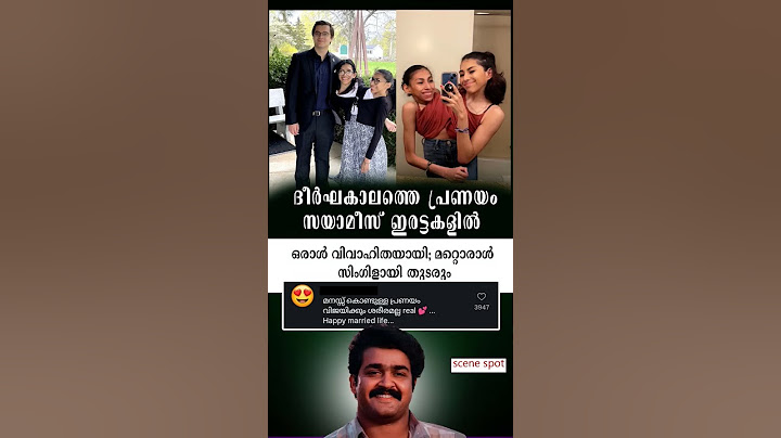 സായാമിസ് ഇരട്ടകളിൽ ഒരാൾ വിവാഹിതയായി 👏🥰