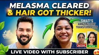 Swati’s Amazing Diet Transformation: Melasma Cleared, Skin Is Fair & Hair Got Thicker!