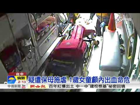 疑遭保母施虐 1歲女童顱內出血命危│中視新聞 20160201