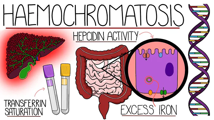 Understanding Haemochromatosis (Hereditary & Secondary)