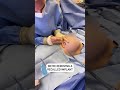 Watch what happens during dr cassileths explant surgery never a dull moment in the operating room