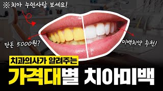 20년 경력의 치과의사가 말하는 가격대별 치아미백 방법 (공짜로 하얘지는법)