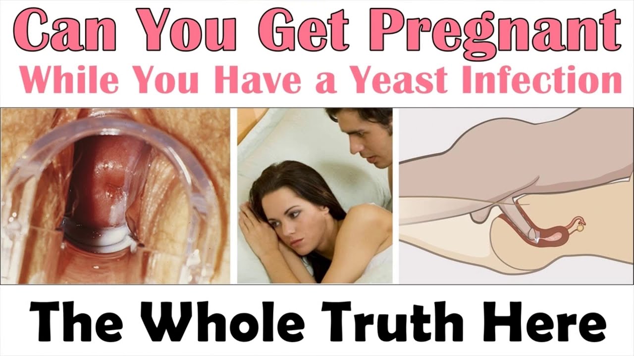 what to do if you get a yeast infection while pregnant