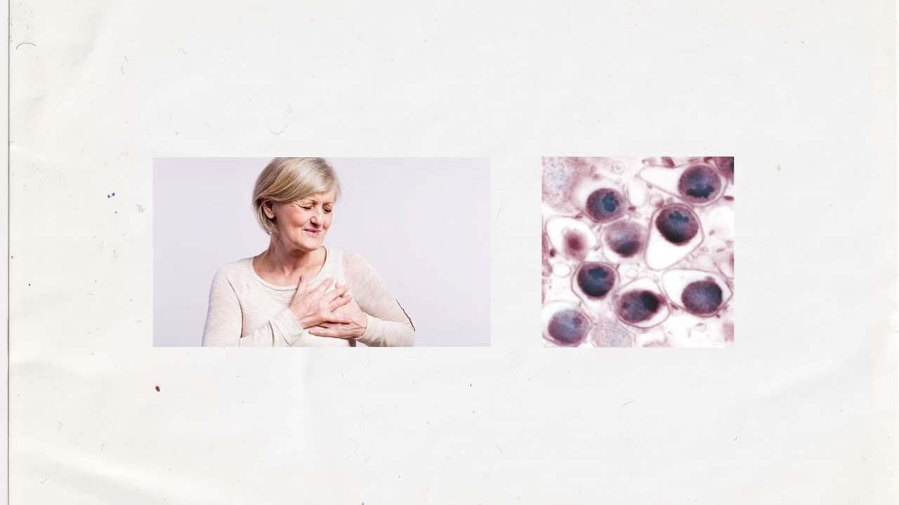 Chlamydia (commission edit)